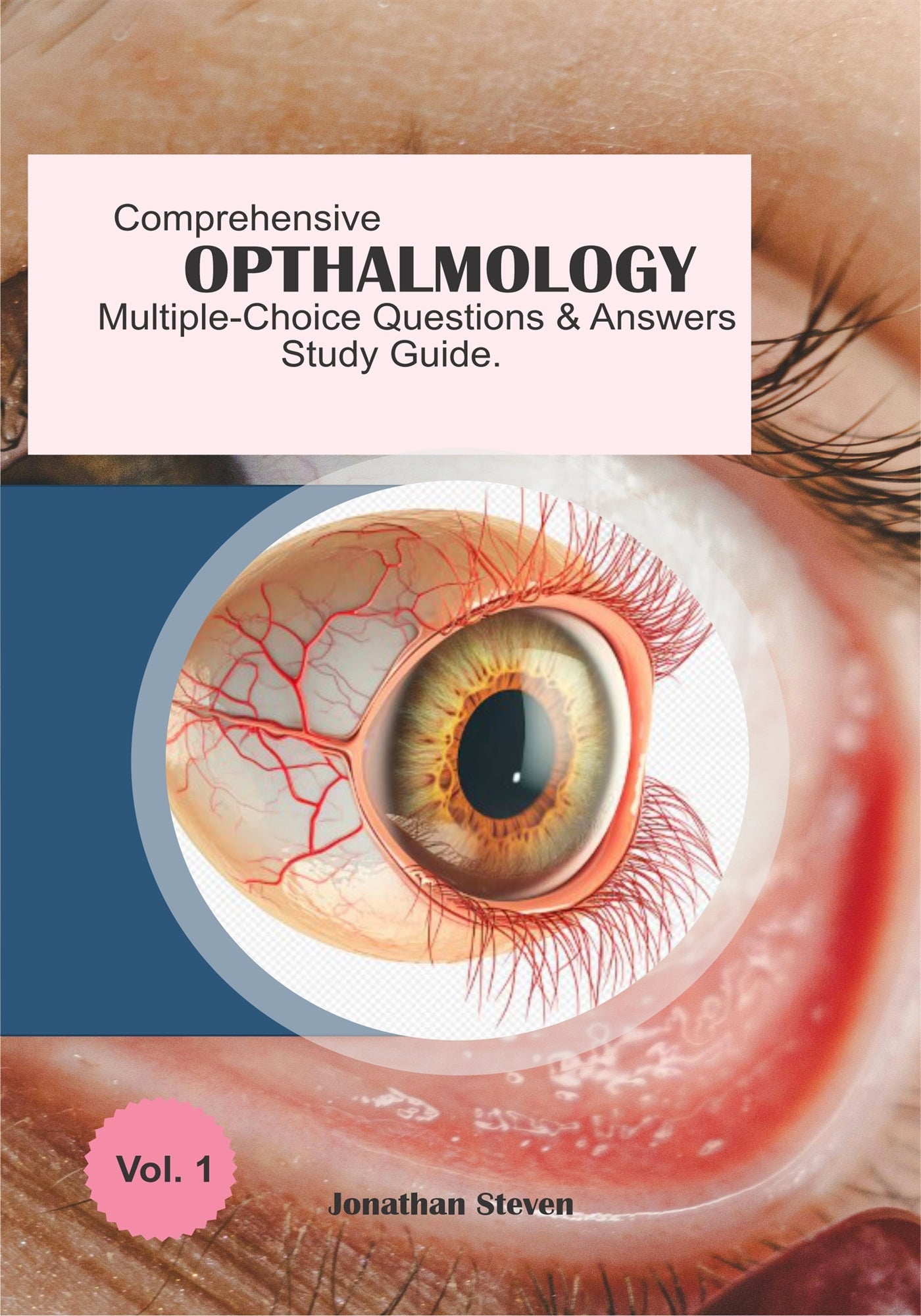Comprehensive Ophthalmology Multiple-Choice Questions and Answers Study Guide – E-bok
