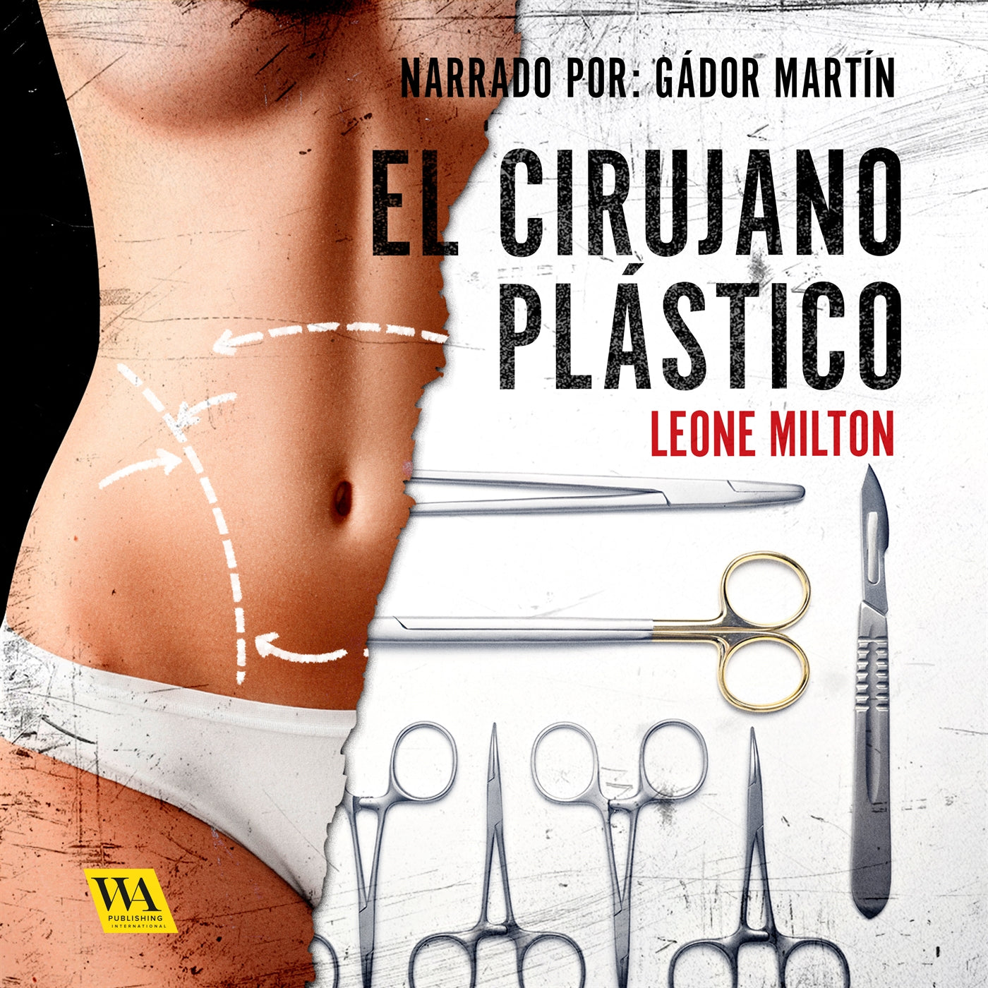 El cirujano plástico – Ljudbok