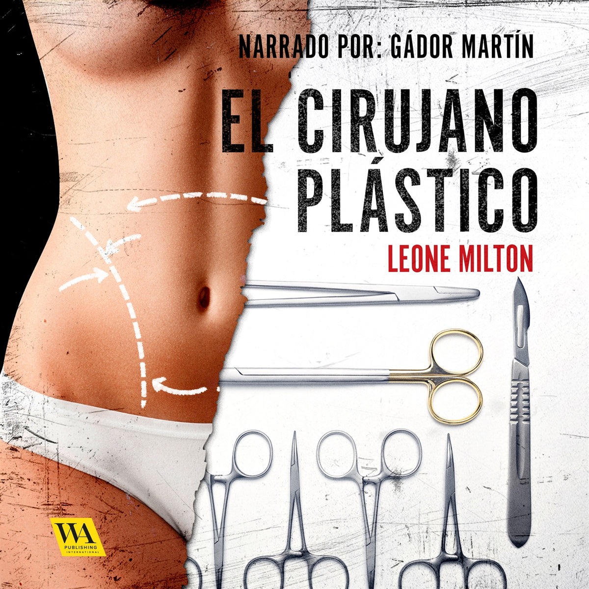 El cirujano plástico – Ljudbok