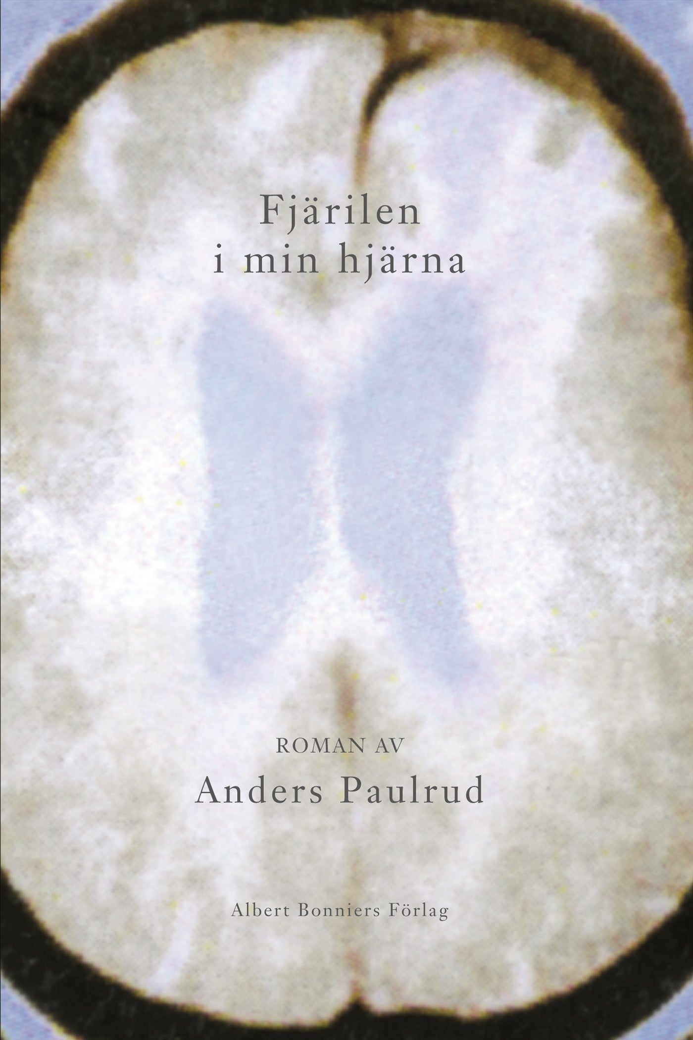 Fjärilen i min hjärna – E-bok