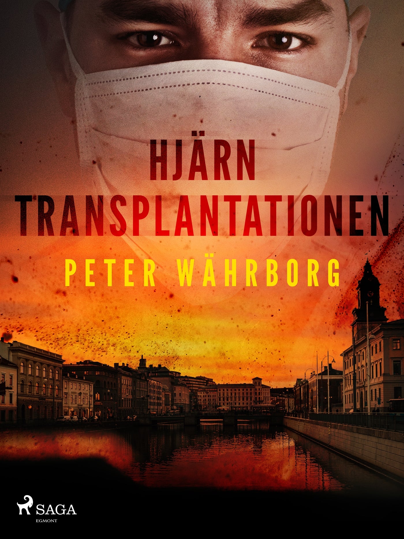 Hjärntransplantationen – E-bok