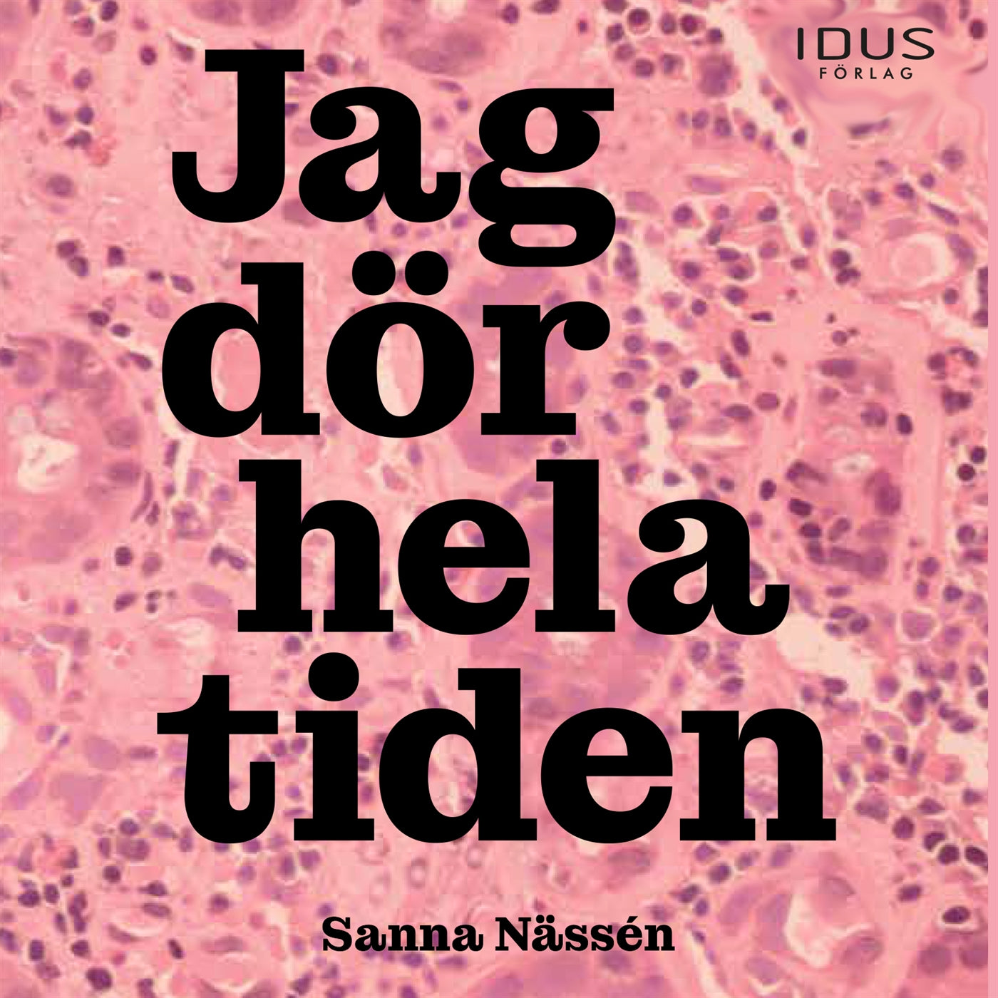 Jag dör hela tiden – Ljudbok