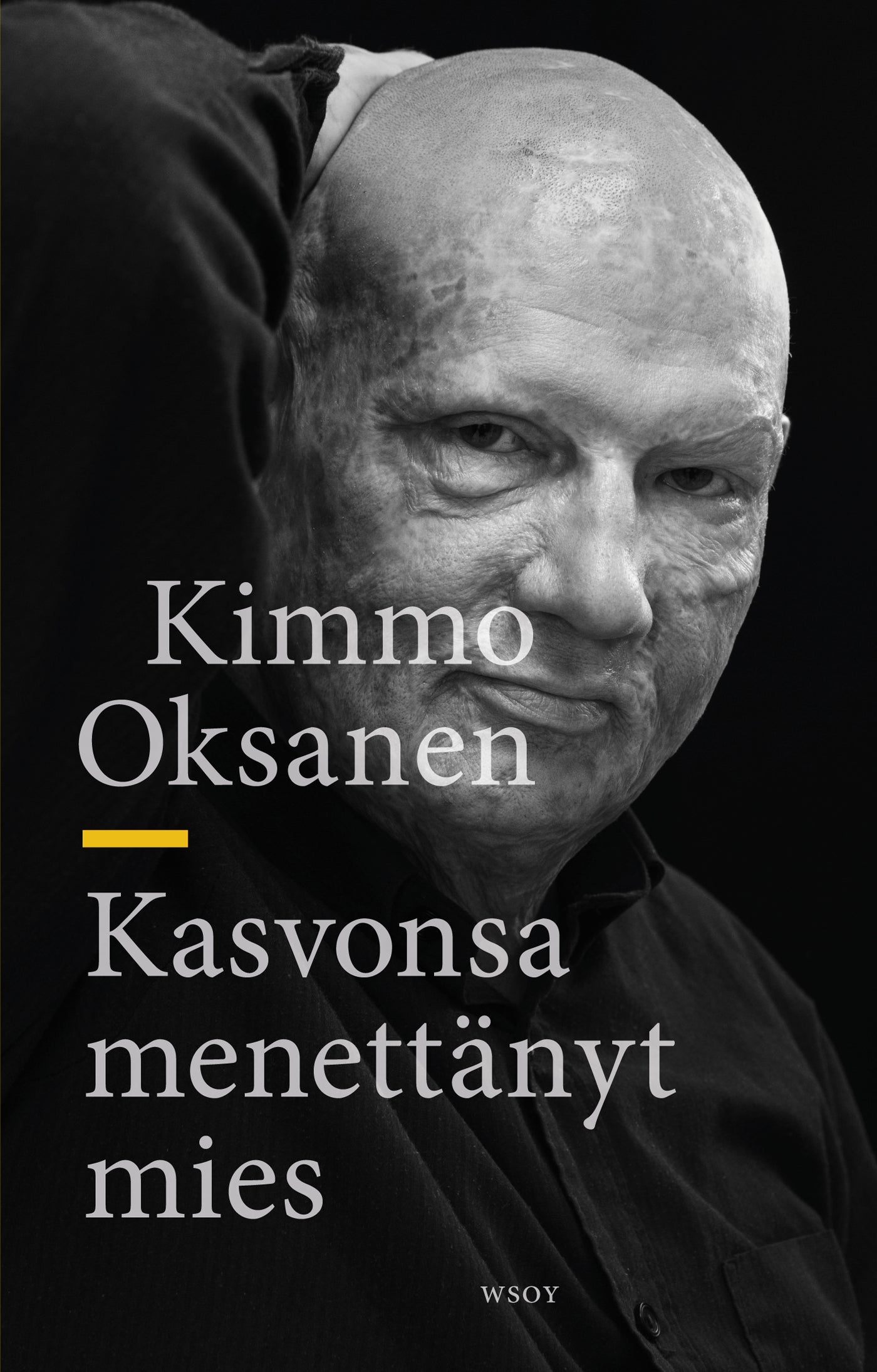 Kasvonsa menettänyt mies – E-bok