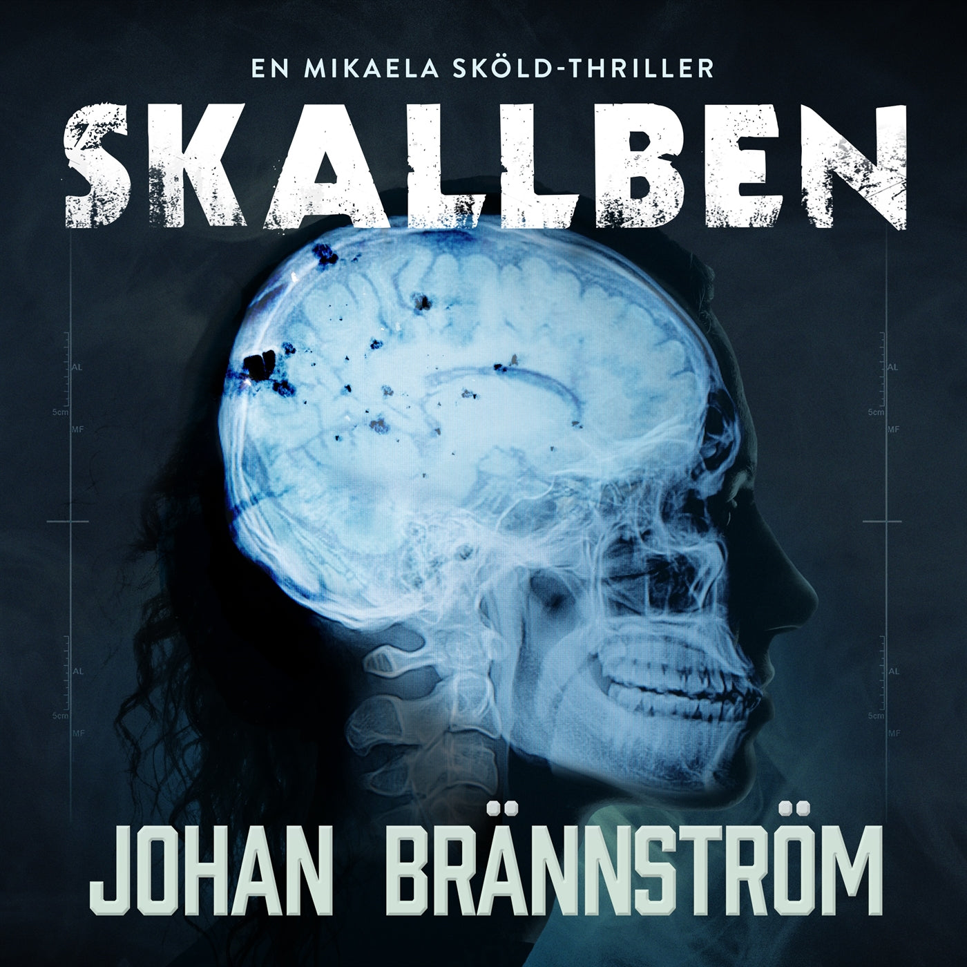 Skallben – Ljudbok