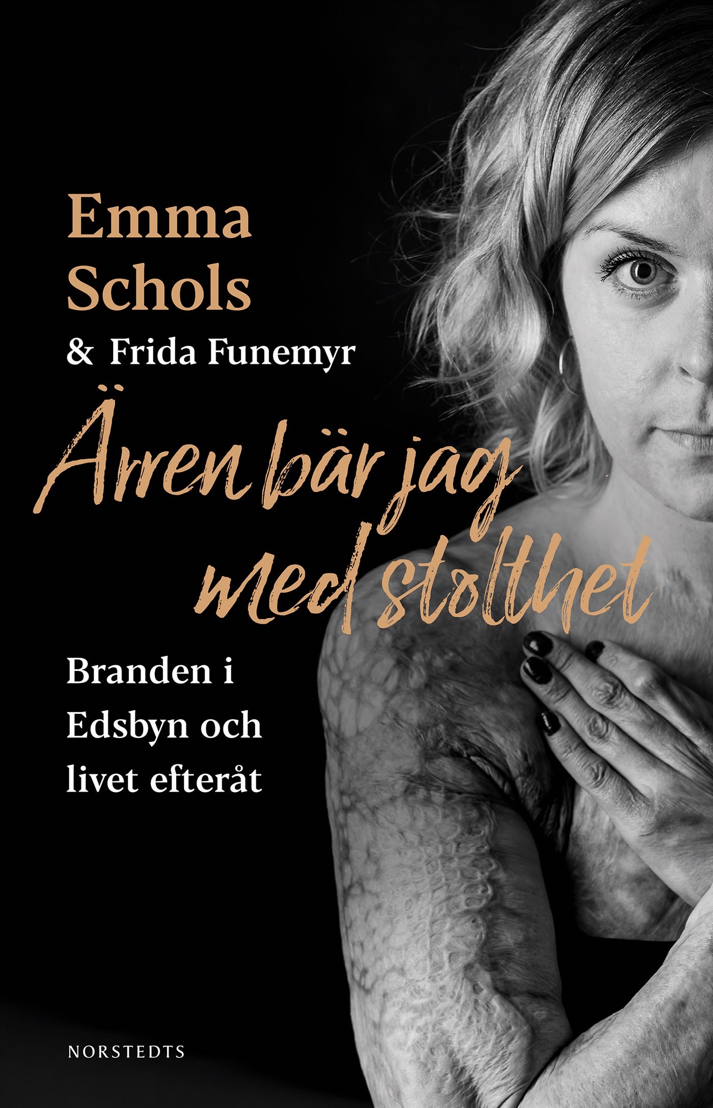 Ärren bär jag med stolthet : branden i Edsbyn och livet efteråt – E-bok