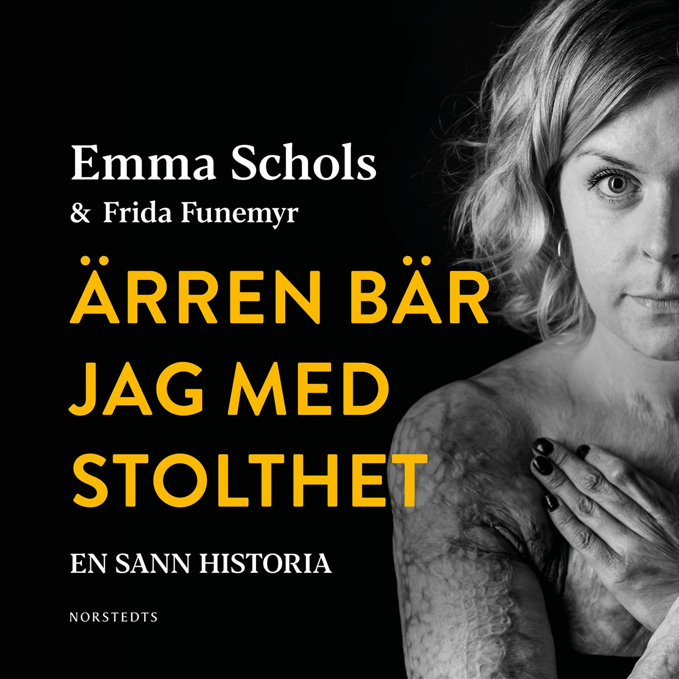 Ärren bär jag med stolthet : branden i Edsbyn och livet efteråt – Ljudbok