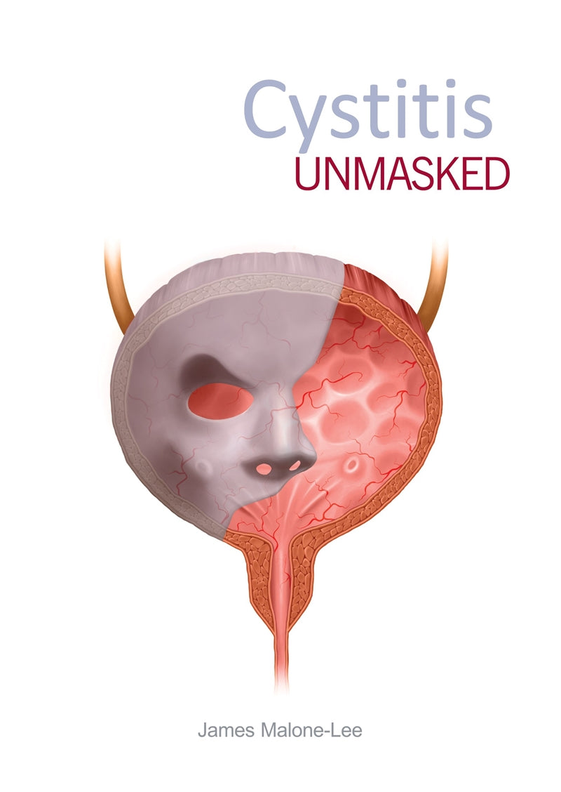 Cystitis unmasked – E-bok
