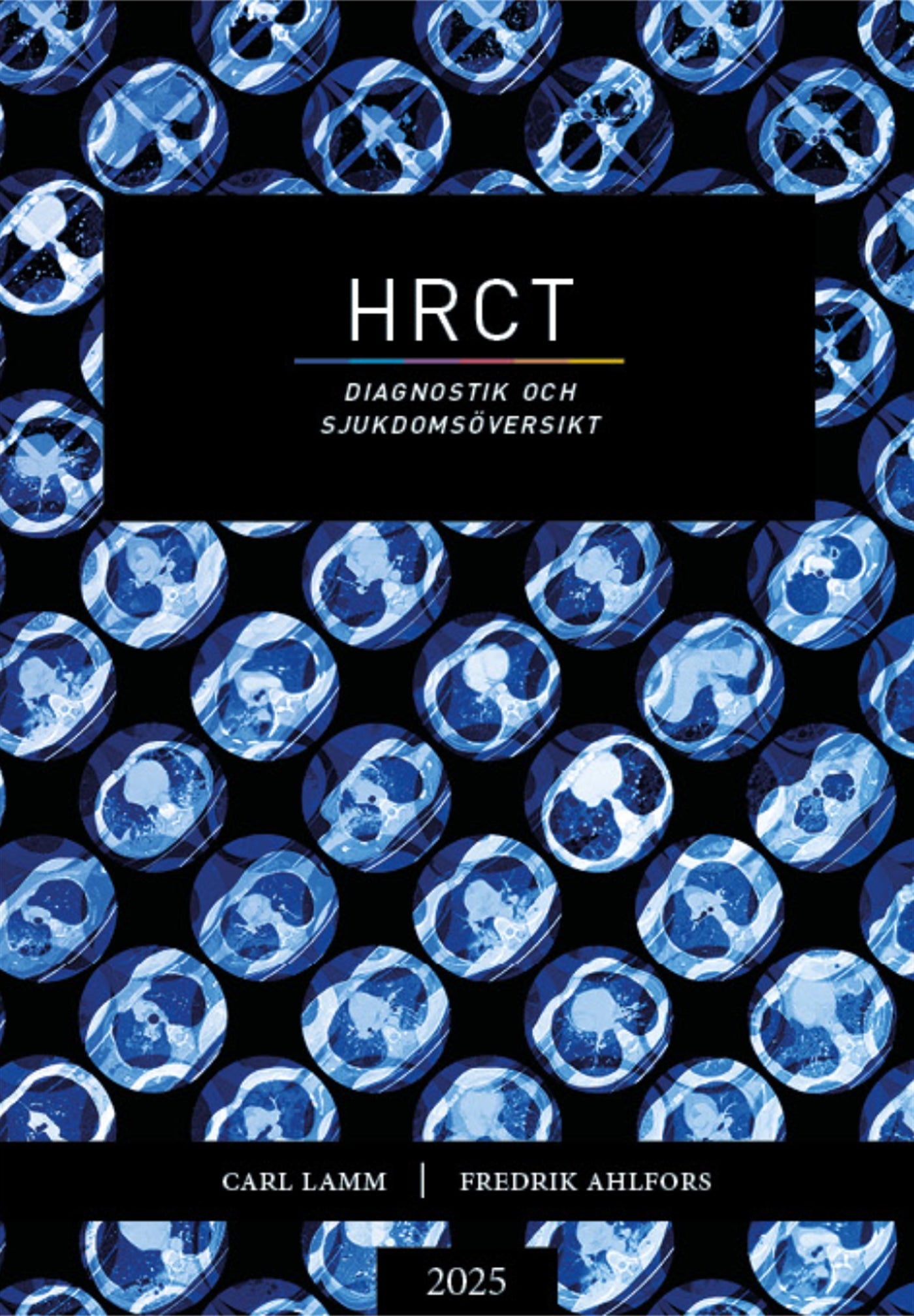 HRCT – Diagnostik och sjukdomsöversikt  – E-bok