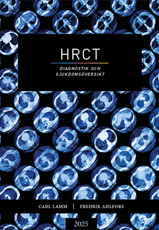 HRCT – Diagnostik och sjukdomsöversikt  – E-bok