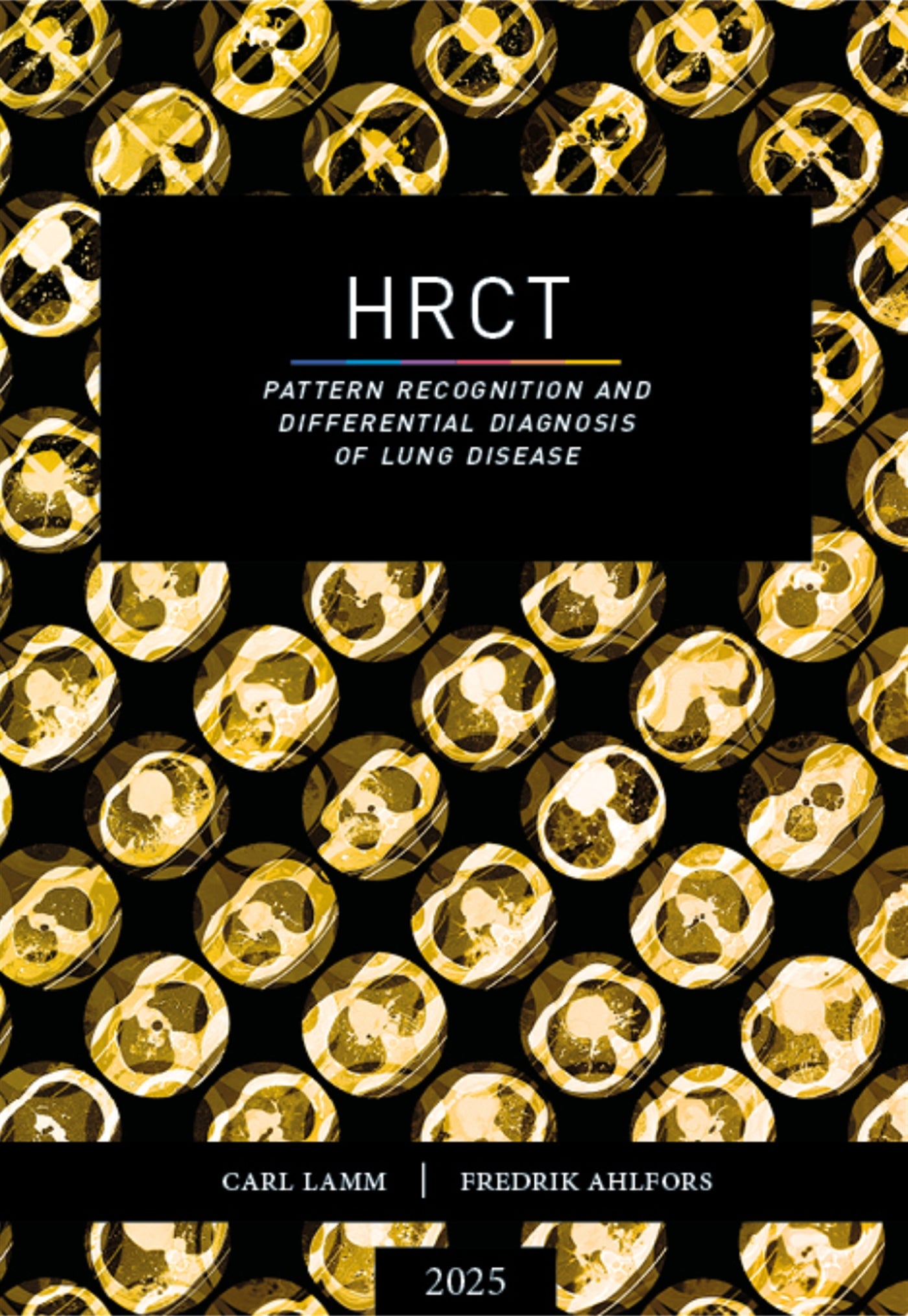 HRCT – pattern recognition and differential diagnosis of lung disease – E-bok