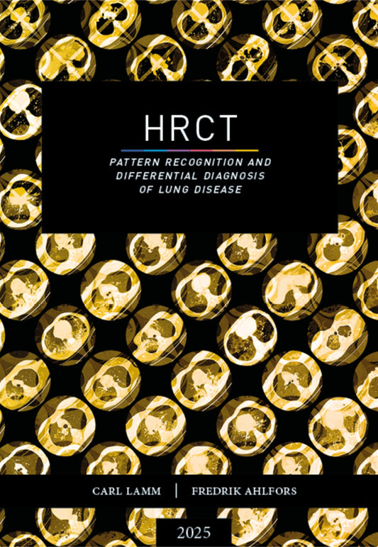 HRCT – pattern recognition and differential diagnosis of lung disease – E-bok