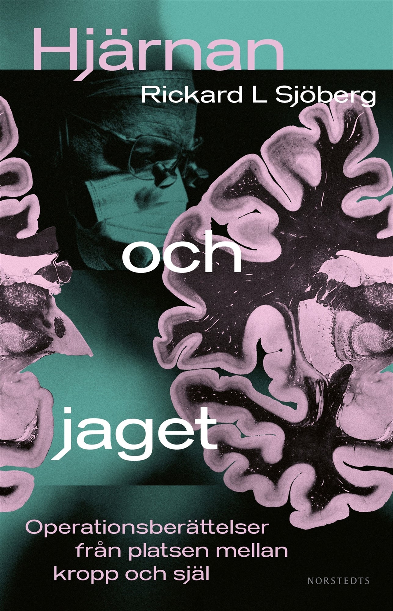 Hjärnan och jaget : operationsberättelser från platsen mellan kropp och själ – E-bok