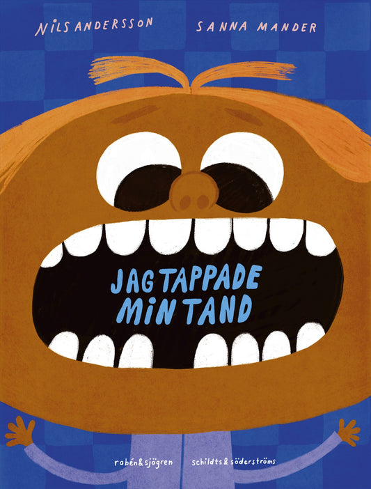 Jag tappade min tand – E-bok
