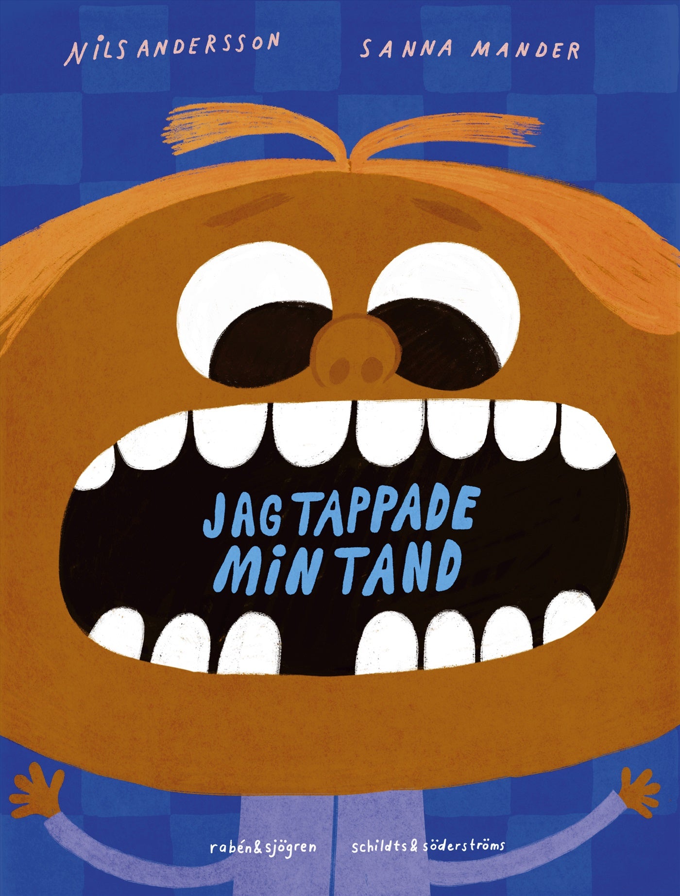 Jag tappade min tand – E-bok