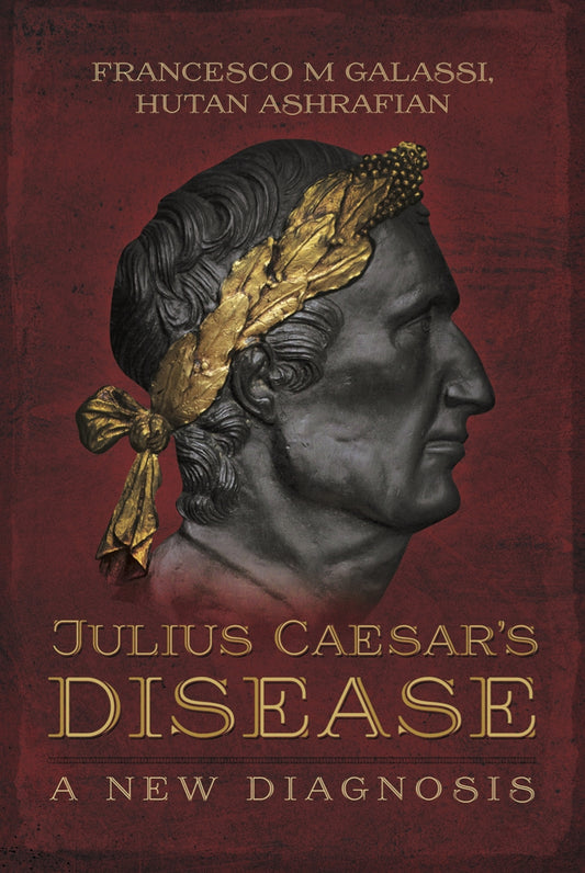 Julius Caesar's Disease – E-bok