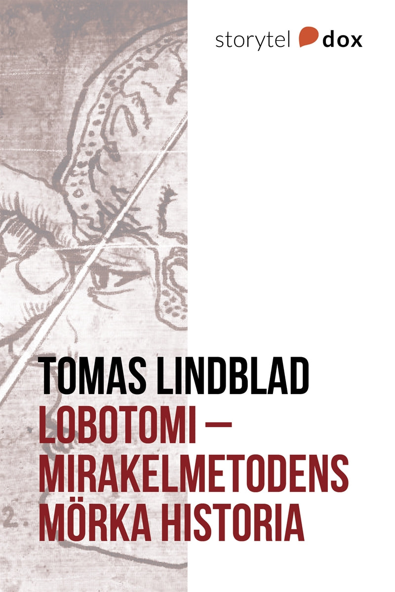 Lobotomi - Mirakelmetodens mörka historia – E-bok
